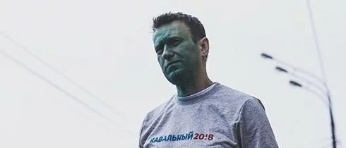 Навальный показал фотографию глаза после операции в Барселоне