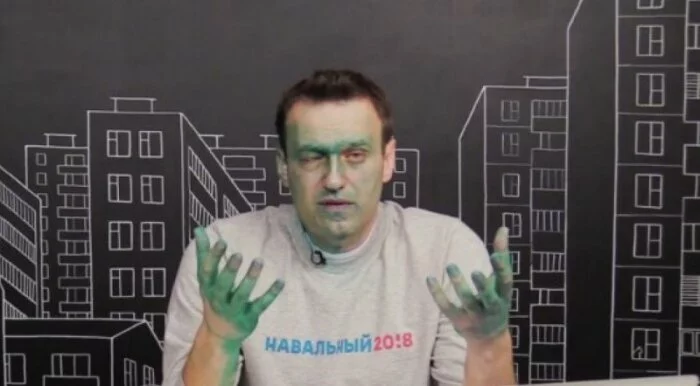 Навальный потерял 80% зрения правого глаза после нападения