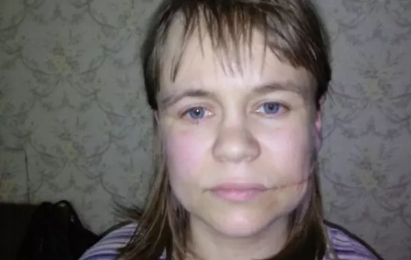 В Пермском крае третий месяц разыскивают пропавшую без вести женщину со шрамами