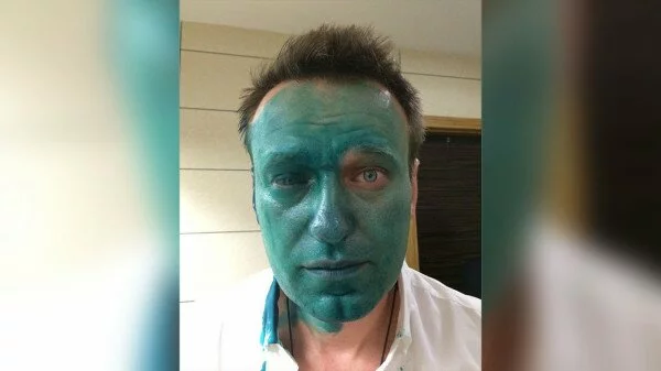 Алексея Навального в Москве снова залили зелёнкой