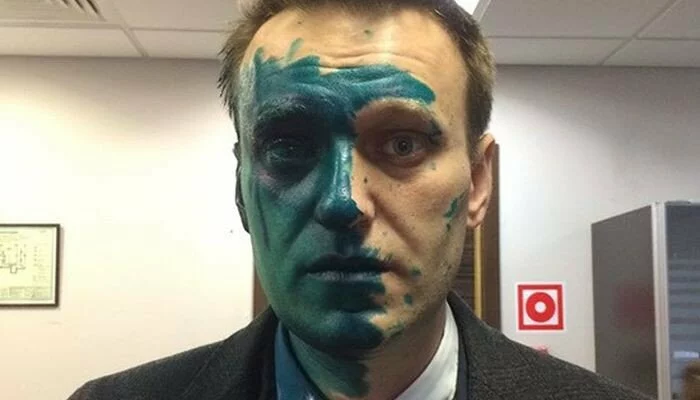 Навальный заявил, что может ослепнуть и обвинил в нападении администрацию Путина