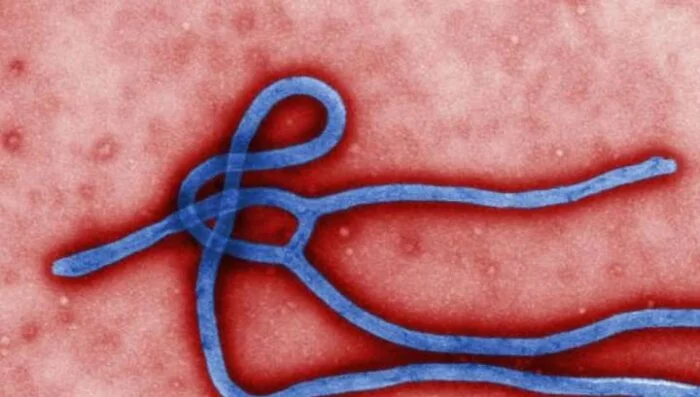 Антитела выжившего после Эболы человека помогут другим больным