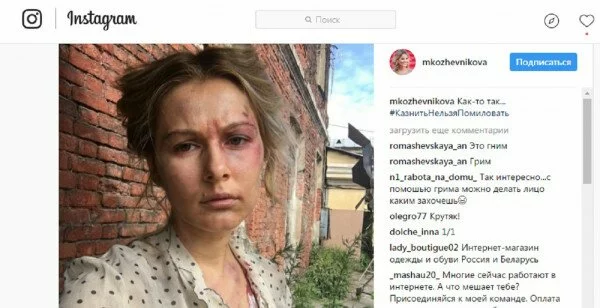 Беременная актриса Мария Кожевникова показала лицо в синяках и ссадинах